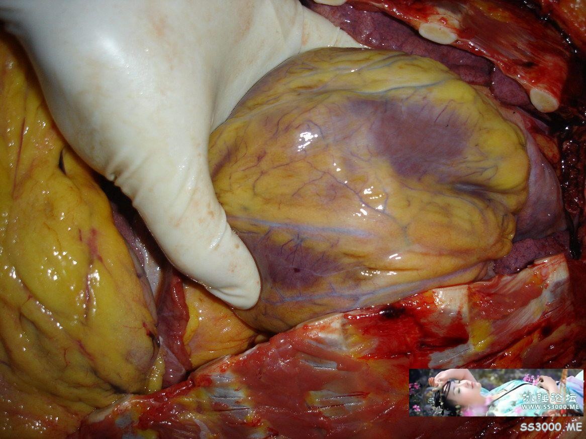 20180609_195831_018.jpg